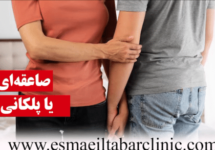 صاعقه ای یا پلکانی؟